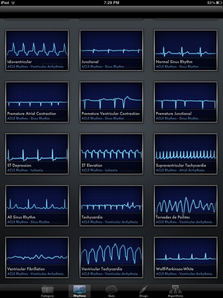 Heart rhythm app iphone